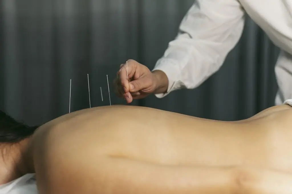 Acupuncturist in Berkel en Rodenrijs